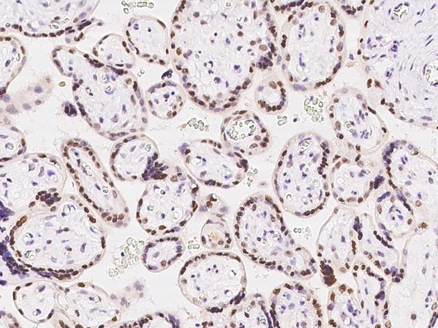 CDYL Antibody - Immunochemical staining of human CDYL in human placenta with rabbit polyclonal antibody at 1:100 dilution, formalin-fixed paraffin embedded sections.