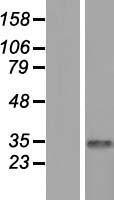 CDYL Protein - Western validation with an anti-DDK antibody * L: Control HEK293 lysate R: Over-expression lysate