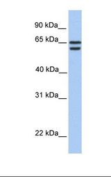 CDYL2 Antibody - 721_B cell lysate. Antibody concentration: 1.0 ug/ml. Gel concentration: 12%.  This image was taken for the unconjugated form of this product. Other forms have not been tested.