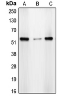 CDYL2 Antibody - Western blot analysis of CDYL2 expression in A431 (A); HepG2 (B); HeLa (C) whole cell lysates.