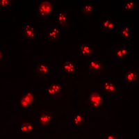 CDYL2 Antibody - Immunofluorescent analysis of CDYL2 staining in HepG2 cells. Formalin-fixed cells were permeabilized with 0.1% Triton X-100 in TBS for 5-10 minutes and blocked with 3% BSA-PBS for 30 minutes at room temperature. Cells were probed with the primary antibody in 3% BSA-PBS and incubated overnight at 4 C in a humidified chamber. Cells were washed with PBST and incubated with a DyLight 594-conjugated secondary antibody (red) in PBS at room temperature in the dark. DAPI was used to stain the cell nuclei (blue).