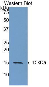CEA / Carcinoembryonic Antigen Antibody - Western blot of CEA / Carcinoembryonic Antigen antibody.