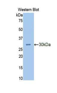 CEA / Carcinoembryonic Antigen Antibody - Western blot of recombinant CEACAM5 / CD66e.  This image was taken for the unconjugated form of this product. Other forms have not been tested.