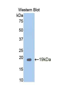 CEA / Carcinoembryonic Antigen Antibody - Western blot of recombinant CEACAM5 / CD66e.  This image was taken for the unconjugated form of this product. Other forms have not been tested.