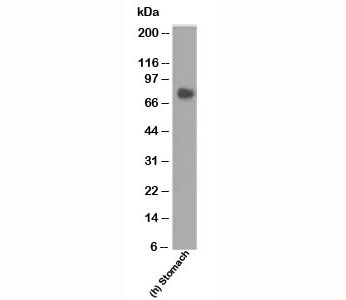 CEA / Carcinoembryonic Antigen Antibody - CEA antibody COL-1 western blot.  This image was taken for the unmodified form of this product. Other forms have not been tested.