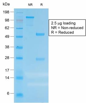 CEACAM1,5 Antibody - SDS-PAGE Analysis of Purified CEA Rabbit Recombinant Monoclonal Antibody (C66/1983R). Confirmation of Purity and Integrity of Antibody.