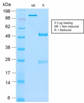 CEACAM1,5 Antibody - SDS-PAGE Analysis Purified CEA Rabbit Recombinant Monoclonal Antibody (C66/2055R). Confirmation of Purity and Integrity of Antibody.