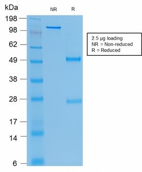 CEACAM1,5 Antibody - SDS-PAGE Analysis Purified CEA Mouse Recombinant Monoclonal Antibody (rC66/1009). Confirmation of Purity and Integrity of Antibody.