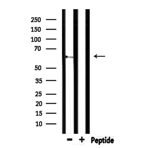 CEACAM20 Antibody - Western blot analysis of extracts of mouse lung using CEACAM20 antibody.