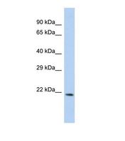 CEACAM21 Antibody - Western blot of Human 293T. CEACAM21 antibody dilution 1.0 ug/ml.  This image was taken for the unconjugated form of this product. Other forms have not been tested.