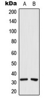 CEACAM21 Antibody - Western blot analysis of CEACAM21 expression in MCF7 (A); PC3 (B) whole cell lysates.