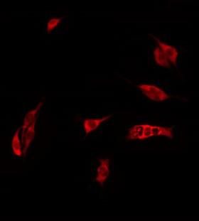 CEACAM21 Antibody - Staining HeLa cells by IF/ICC. The samples were fixed with PFA and permeabilized in 0.1% Triton X-100, then blocked in 10% serum for 45 min at 25°C. The primary antibody was diluted at 1:200 and incubated with the sample for 1 hour at 37°C. An Alexa Fluor 594 conjugated goat anti-rabbit IgG (H+L) Ab, diluted at 1/600, was used as the secondary antibody.