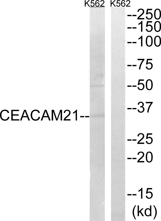 CEACAM21 Antibody - Western blot analysis of extracts from K562 cells, using CEACAM21 antibody.