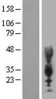 CEACAM21 Protein - Western validation with an anti-DDK antibody * L: Control HEK293 lysate R: Over-expression lysate