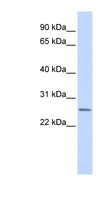CEACAM4 Antibody - CEACAM4 antibody Western blot of Fetal Lung lysate. This image was taken for the unconjugated form of this product. Other forms have not been tested.