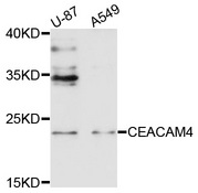 CEACAM4 Antibody - Western blot analysis of extracts of various cell lines, using CEACAM4 antibody at 1:1000 dilution. The secondary antibody used was an HRP Goat Anti-Rabbit IgG (H+L) at 1:10000 dilution. Lysates were loaded 25ug per lane and 3% nonfat dry milk in TBST was used for blocking. An ECL Kit was used for detection and the exposure time was 30s.