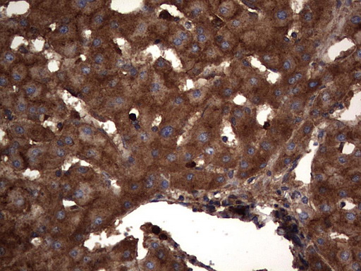 CEACAM5 / CD66e Antibody - IHC of paraffin-embedded Human liver tissue using anti-CEACAM5 mouse monoclonal antibody. (Heat-induced epitope retrieval by 1 mM EDTA in 10mM Tris, pH9.0, 120°C for 3min).