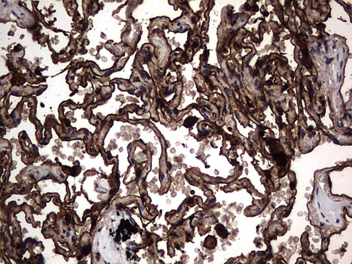 CEACAM5 / CD66e Antibody - IHC of paraffin-embedded Human lung tissue using anti-CEACAM5 mouse monoclonal antibody. (Heat-induced epitope retrieval by 1 mM EDTA in 10mM Tris, pH9.0, 120°C for 3min).