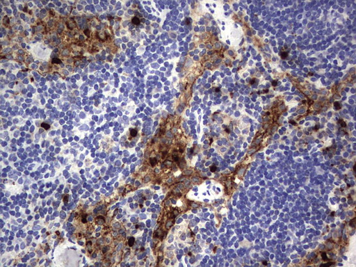 CEACAM5 / CD66e Antibody - IHC of paraffin-embedded Human lymph node tissue using anti-CEACAM5 mouse monoclonal antibody. (Heat-induced epitope retrieval by 1 mM EDTA in 10mM Tris, pH9.0, 120°C for 3min).