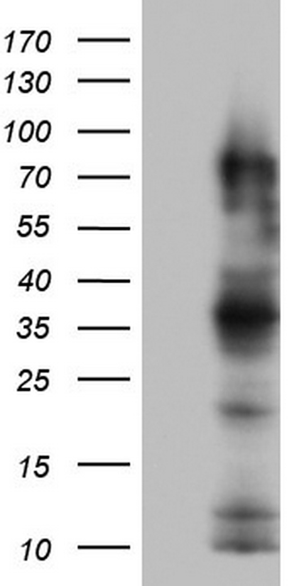 CEACAM5 / CD66e Antibody - HEK293T cells were transfected with the pCMV6-ENTRY control (Left lane) or pCMV6-ENTRY CEACAM5 (Right lane) cDNA for 48 hrs and lysed. Equivalent amounts of cell lysates (5 ug per lane) were separated by SDS-PAGE and immunoblotted with anti-CEACAM5.