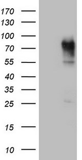 CEACAM5 / CD66e Antibody - HEK293T cells were transfected with the pCMV6-ENTRY control (Left lane) or pCMV6-ENTRY CEACAM5 (Right lane) cDNA for 48 hrs and lysed. Equivalent amounts of cell lysates (5 ug per lane) were separated by SDS-PAGE and immunoblotted with anti-CEACAM5.