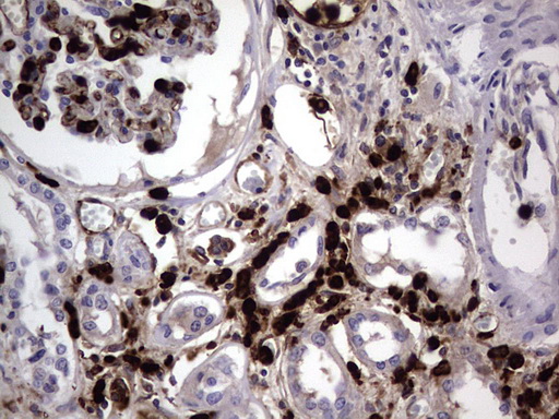 CEACAM5 / CD66e Antibody - IHC of paraffin-embedded Human Kidney tissue using anti-CEACAM5 mouse monoclonal antibody. (heat-induced epitope retrieval by 1 mM EDTA in 10mM Tris, pH8.5, 120°C for 3min).