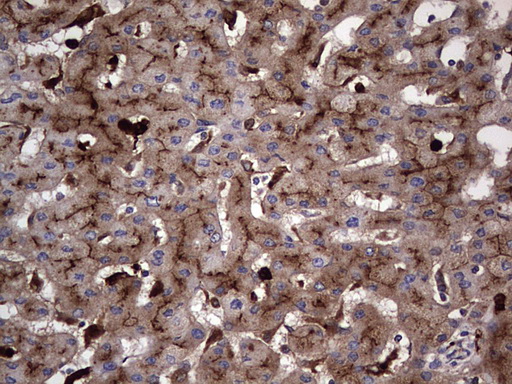 CEACAM5 / CD66e Antibody - IHC of paraffin-embedded Human liver tissue using anti-CEACAM5 mouse monoclonal antibody. (heat-induced epitope retrieval by 1 mM EDTA in 10mM Tris, pH8.5, 120°C for 3min).