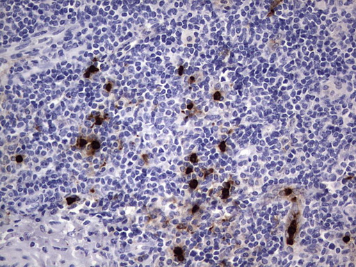 CEACAM5 / CD66e Antibody - IHC of paraffin-embedded Human tonsil using anti-CEACAM5 mouse monoclonal antibody. (heat-induced epitope retrieval by 1 mM EDTA in 10mM Tris, pH8.5, 120°C for 3min).