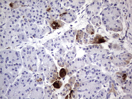 CEACAM5 / CD66e Antibody - IHC of paraffin-embedded Human pancreas tissue using anti-CEACAM5 mouse monoclonal antibody. (heat-induced epitope retrieval by 1 mM EDTA in 10mM Tris, pH8.5, 120°C for 3min).