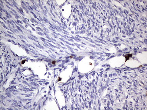 CEACAM5 / CD66e Antibody - IHC of paraffin-embedded Human endometrium tissue using anti-CEACAM5 mouse monoclonal antibody. (heat-induced epitope retrieval by 1 mM EDTA in 10mM Tris, pH8.5, 120°C for 3min).