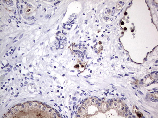 CEACAM5 / CD66e Antibody - IHC of paraffin-embedded Human prostate tissue using anti-CEACAM5 mouse monoclonal antibody. (heat-induced epitope retrieval by 1 mM EDTA in 10mM Tris, pH8.5, 120°C for 3min).