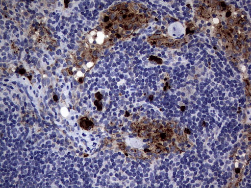 CEACAM5 / CD66e Antibody - IHC of paraffin-embedded Human lymph node tissue using anti-CEACAM5 mouse monoclonal antibody. (Heat-induced epitope retrieval by 1 mM EDTA in 10mM Tris, pH9.0, 120°C for 3min).