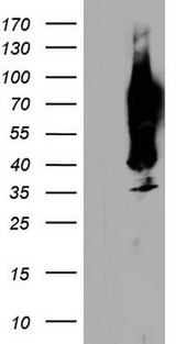 CEACAM5 / CD66e Antibody - HEK293T cells were transfected with the pCMV6-ENTRY control (Left lane) or pCMV6-ENTRY CEACAM5 (Right lane) cDNA for 48 hrs and lysed. Equivalent amounts of cell lysates (5 ug per lane) were separated by SDS-PAGE and immunoblotted with anti-CEACAM5.