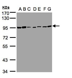 CEACAM5 / CD66e Antibody - Sample (30g whole cell lysate). A:293T, B: A431 , C: H1299, D: HeLa S3 , E: Hep G2 . F: MOLT4 . G: Raji . 7.5% SDS PAGE. CEACAM5 / CEA antibody diluted at 1:1000
