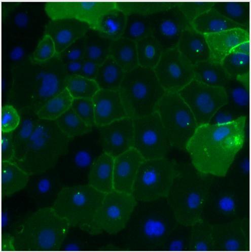 CEACAM5 / CD66e Antibody - Immunofluorescent analysis of Carcinoembryonic Antigen (CEA, green) in BxPC-3 cells. Cells were fixed with 4% paraformaldehyde, permeabilized with 0.1% Triton X-100, and blocked with 0.3% BSA in PBS, each for 15 minutes at room temperature. Cells were stained with a CEA monoclonal antibody at a dilution of 10 µg/mL in blocking buffer for 1 hour at room temperature, and then incubated with a goat anti-mouse IgG Superclonal secondary antibody, Alexa Fluor® 488 conjugate at a dilution of 1:1000 for 1 hour at room temperature. Nuclei (blue) were stained with Hoechst nuclear stain. Images were taken on a Thermo Scientific ToxInsight Instrument at 20X magnification.