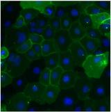 CEACAM5 / CD66e Antibody - Immunofluorescent analysis of Carcinoembryonic Antigen (CEA, green) in BxPC-3 cells. Cells were fixed with 4% paraformaldehyde, permeabilized with 0.1% Triton X-100, and blocked with 0.3% BSA in PBS, each for 15 minutes at room temperature. Cells were stained with a CEA monoclonal antibody at a dilution of 10 µg/mL in blocking buffer for 1 hour at room temperature, and then incubated with a goat anti-mouse IgG Superclonal secondary antibody, Alexa Fluor® 488 conjugate at a dilution of 1:1000 for 1 hour at room temperature. Nuclei (blue) were stained with Hoechst nuclear stain. Images were taken on a Thermo Scientific ToxInsight Instrument at 20X magnification.