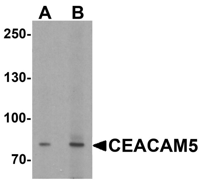 CEACAM5 / CD66e Antibody - Western blot analysis of CEACAM5 in rat lung tissue lysate with CEACAM5 antibody at (A) 1 and (B) 2 ug/ml.