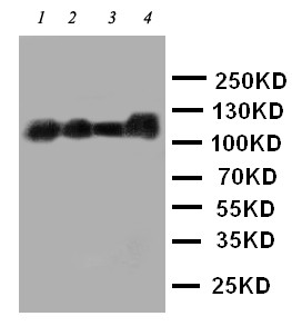 CEACAM5 / CD66e Antibody - WB of CEACAM5 / CD66e antibody. Lane 1: Recombinant Human CEA Protein 5ng. Lane 2: Recombinant Human CEA Protein 2.5ng. Lane 3: Recombinant Human CEA Protein 1.25ng. Lane 4: SW620 Cell Lysate.