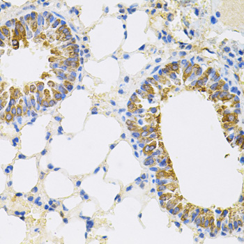 CEACAM5 / CD66e Antibody - Immunohistochemistry of paraffin-embedded mouse lung tissue.