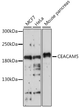 CEACAM5 / CD66e Antibody - Western blot analysis of extracts of various cell lines, using CEACAM5 antibody at 1:1000 dilution. The secondary antibody used was an HRP Goat Anti-Rabbit IgG (H+L) at 1:10000 dilution. Lysates were loaded 25ug per lane and 3% nonfat dry milk in TBST was used for blocking. An ECL Kit was used for detection and the exposure time was 180s.