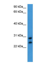 CEACAM7 Antibody - CEACAM7 antibody Western blot of HeLa lysate.  This image was taken for the unconjugated form of this product. Other forms have not been tested.