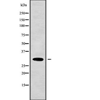 CEACAM7 Antibody - Western blot analysis of CEACAM7 using Jurkat whole cells lysates