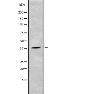 CEACAM8 / CD66b Antibody - Western blot analysis of CEACAM8 using HeLa whole cells lysates