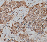 CEACAM8 / CD66b Antibody - 1:200 staining human liver tissue by IHC-P. The tissue was formaldehyde fixed and a heat mediated antigen retrieval step in citrate buffer was performed. The tissue was then blocked and incubated with the antibody for 1.5 hours at 22°C. An HRP conjugated goat anti-rabbit antibody was used as the secondary.