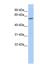 CEAL2 / CEACAM16 Antibody - CEACAM16 antibody Western blot of Fetal Brain lysate. This image was taken for the unconjugated form of this product. Other forms have not been tested.