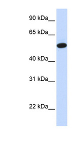 CEAL2 / CEACAM16 Antibody - CEACAM16 antibody Western blot of Fetal Liver lysate. This image was taken for the unconjugated form of this product. Other forms have not been tested.