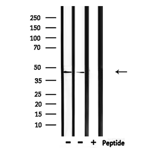 CEAL2 / CEACAM16 Antibody - Western blot analysis of extracts of mouse brain, mouse lung using CEACAM16 antibody.