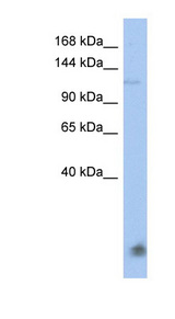 CEB1 / HERC5 Antibody - HERC5 antibody western blot of HT1080 cell lysate.  This image was taken for the unconjugated form of this product. Other forms have not been tested.