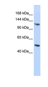 CEB1 / HERC5 Antibody - HERC5 antibody Western blot of HepG2 cell lysate.  This image was taken for the unconjugated form of this product. Other forms have not been tested.