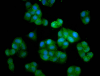 CEB1 / HERC5 Antibody - Immunofluorescence staining of Hela cells diluted at 1:33, counter-stained with DAPI. The cells were fixed in 4% formaldehyde, permeabilized using 0.2% Triton X-100 and blocked in 10% normal Goat Serum. The cells were then incubated with the antibody overnight at 4°C.The Secondary antibody was Alexa Fluor 488-congugated AffiniPure Goat Anti-Rabbit IgG (H+L).